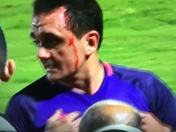 Así quedó el árbitro Bruno Rodríguez tras ser golpeado por jugadores de Treinta y Tres