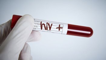 El VIH generó la mayor pandemia que vivió el mundo a finales del siglo XX