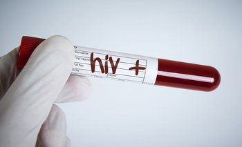 El VIH generó la mayor pandemia que vivió el mundo a finales del siglo XX