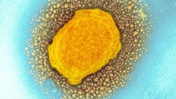 Partícula del virus de la viruela del mono, micrografía de transmisión de electrones coloreada.