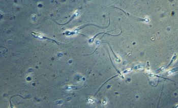 La interpretación del aleteo de los espermatozoides estaba basado en imágenes en dos dimensiones
