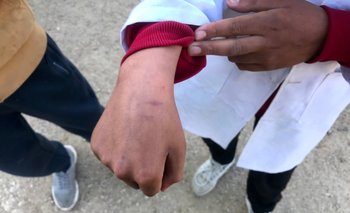 Uno de los escolares que se cortó con el sacapuntas en Barros Blancos.