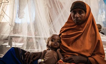 Muchos niños tienen graves problemas de salud debido a la falta de alimentos en Somalia.