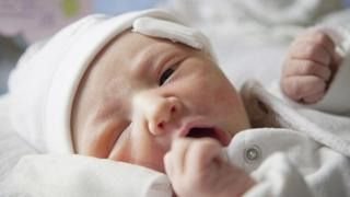 Getty Images Los fórceps pueden provocar lesiones en el recién nacido, pero su implementación en las salas de parto igual permitió salvar vidas de bebés y madres.