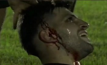Diego Meirana, de Juanicó, terminó con un corte profundo en su cabeza