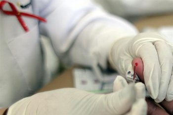 En 2021 la tasa de mortalidad del VIH/SIDA fue la más baja del quinquenio