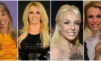 Britney Spears y los  cambios que experimentó su rostro.<br>