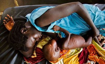 Una madre amamanta a su hijo que sufre de desnutrición en Sudán del Sur